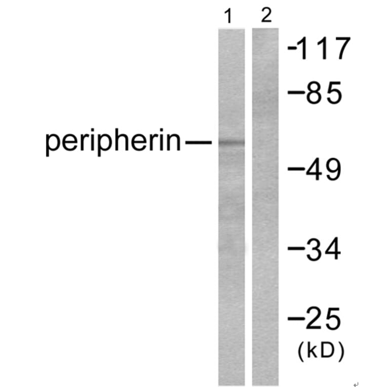 Western blot - Peripherin Antibody from Signalway Antibody (33471) - Antibodies.com