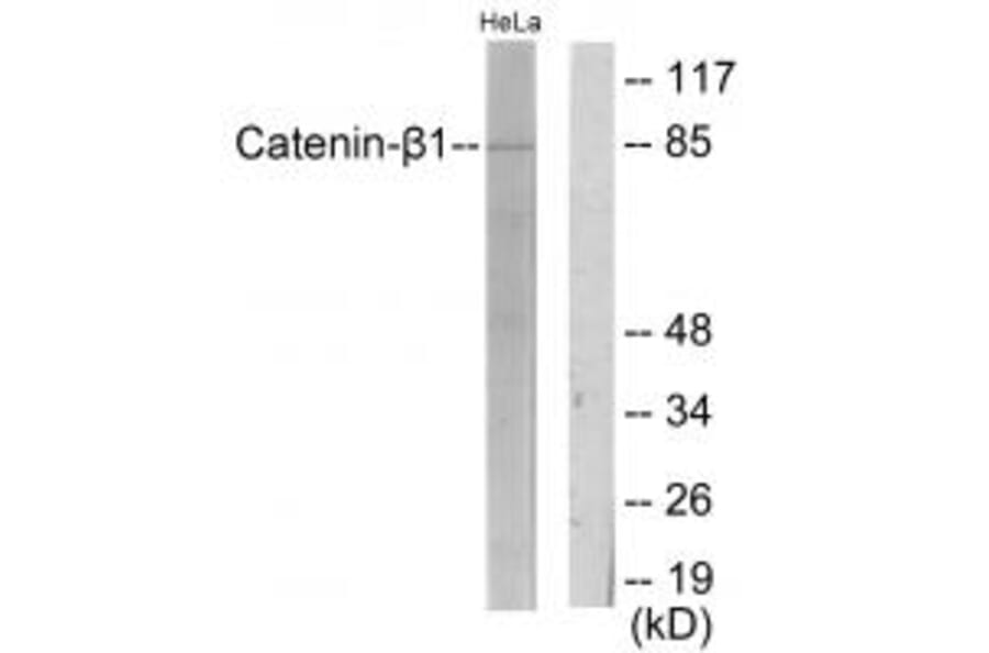 Western blot - Catenin-β1 Antibody from Signalway Antibody (33757) - Antibodies.com