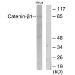 Western blot - Catenin-β1 Antibody from Signalway Antibody (33757) - Antibodies.com