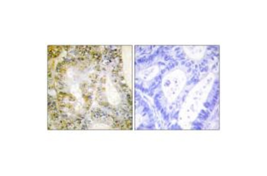 Immunohistochemistry - Catenin-β1 Antibody from Signalway Antibody (33757) - Antibodies.com