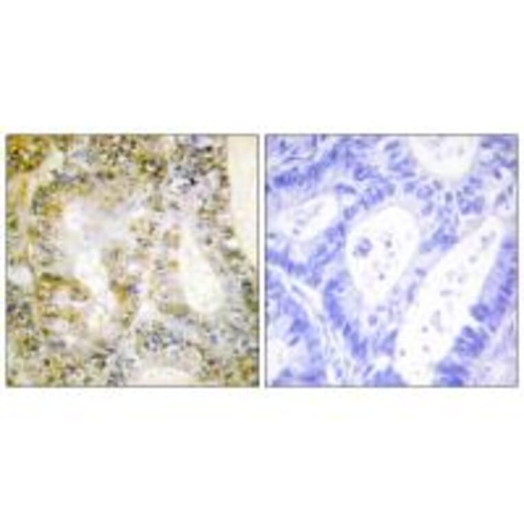 Immunohistochemistry - Catenin-β1 Antibody from Signalway Antibody (33757) - Antibodies.com