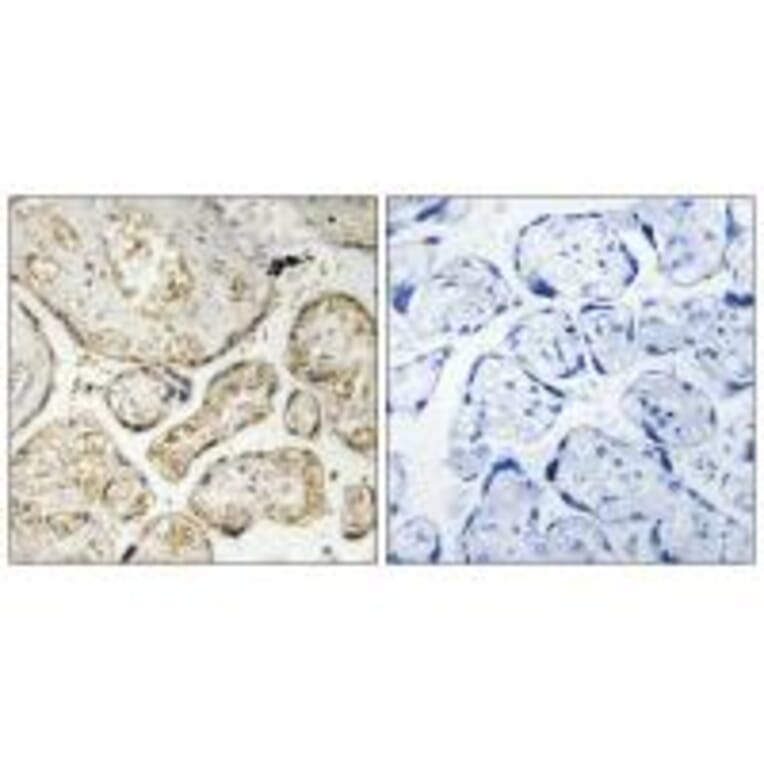 Immunohistochemistry - APOBEC3D/F Antibody from Signalway Antibody (34926) - Antibodies.com