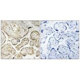 Immunohistochemistry - APOBEC3D/F Antibody from Signalway Antibody (34926) - Antibodies.com
