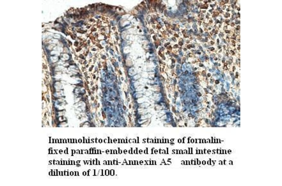 Annexin A5 Antibody from Signalway Antibody (39410) - Antibodies.com