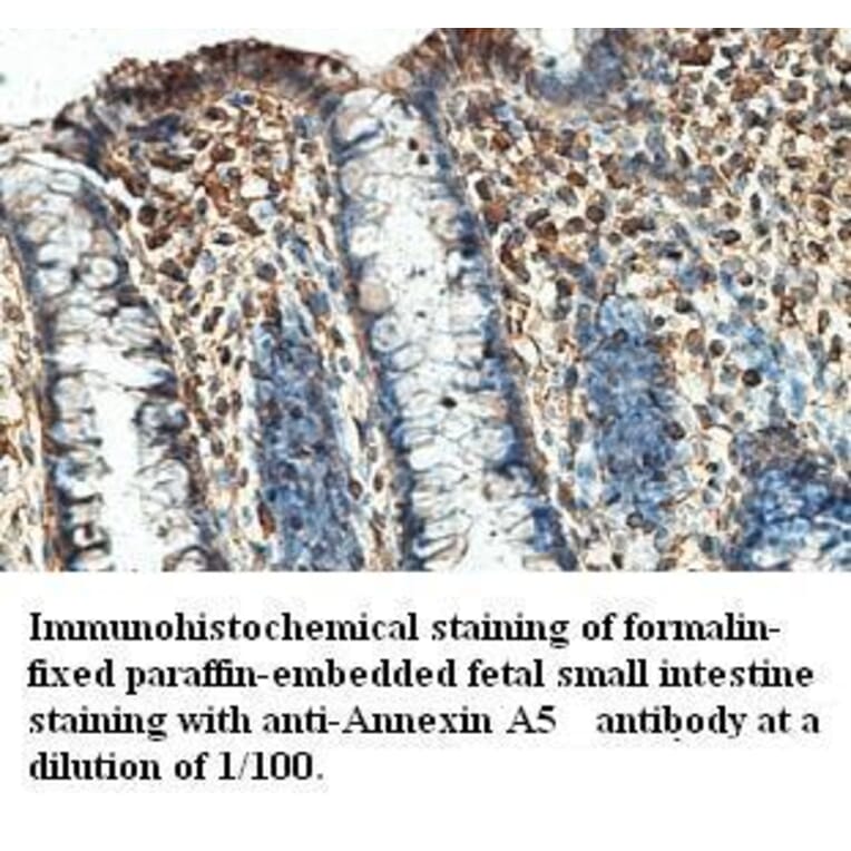 Annexin A5 Antibody from Signalway Antibody (39410) - Antibodies.com