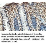 Annexin A5 Antibody from Signalway Antibody (39410) - Antibodies.com