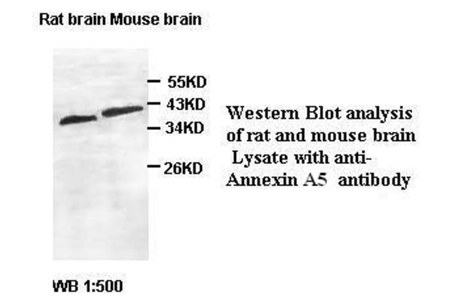 Annexin A5 Antibody from Signalway Antibody (39410) - Antibodies.com