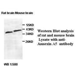 Annexin A5 Antibody from Signalway Antibody (39410) - Antibodies.com