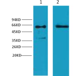 Western blot - Cytokeratin 6 Mouse Monoclonal Antibody from Signalway Antibody (38037) - Antibodies.com