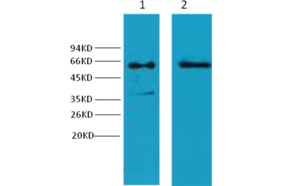Western blot - Cytokeratin 6 Mouse Monoclonal Antibody from Signalway Antibody (38037) - Antibodies.com