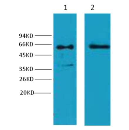 Western blot - Cytokeratin 6 Mouse Monoclonal Antibody from Signalway Antibody (38037) - Antibodies.com