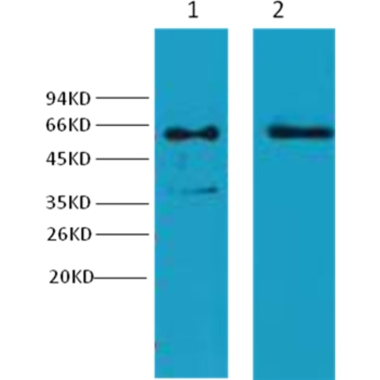 Western blot - Cytokeratin 6 Mouse Monoclonal Antibody from Signalway Antibody (38037) - Antibodies.com