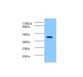 ELAV-like protein 2 Polyclonal Antibody from Signalway Antibody (42158) - Antibodies.com