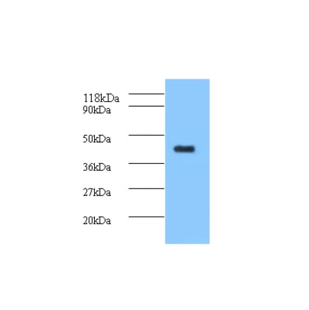 ELAV-like protein 2 Polyclonal Antibody from Signalway Antibody (42158) - Antibodies.com