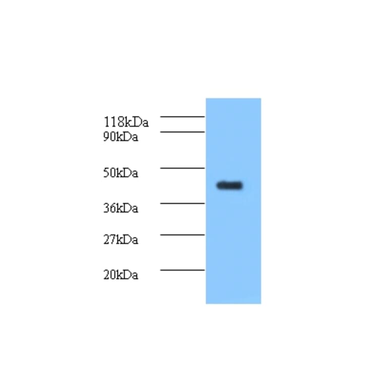 ELAV-like protein 2 Polyclonal Antibody from Signalway Antibody (42158) - Antibodies.com