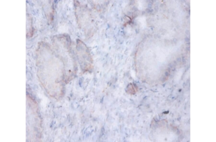 Immunohistochemistry - AFG3-like protein 2 Polyclonal Antibody from Signalway Antibody (42407) - Antibodies.com