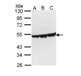 Enolase 3 antibody from Signalway Antibody (22360) - Antibodies.com