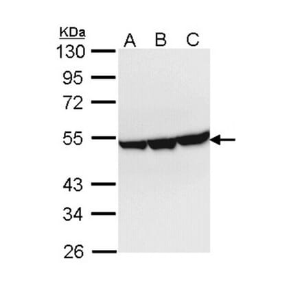 Enolase 3 antibody from Signalway Antibody (22360) - Antibodies.com