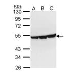 Enolase 3 antibody from Signalway Antibody (22360) - Antibodies.com