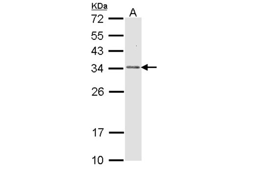 CapZ-beta antibody from Signalway Antibody (22491) - Antibodies.com
