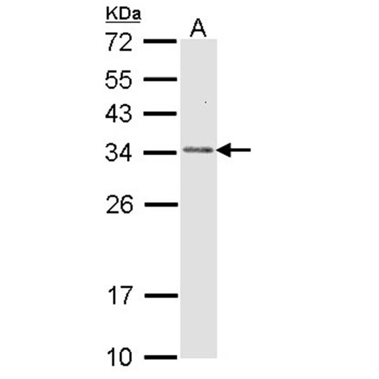 CapZ-beta antibody from Signalway Antibody (22491) - Antibodies.com