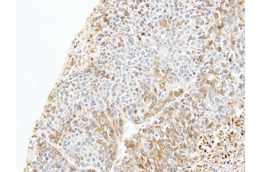 Immunohistochemistry - CapZ-beta antibody from Signalway Antibody (22491) - Antibodies.com