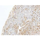 Immunohistochemistry - CapZ-beta antibody from Signalway Antibody (22491) - Antibodies.com