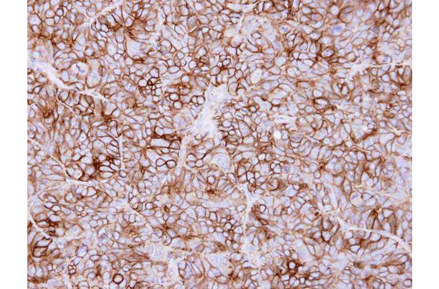 Immunohistochemistry - KIDINS220 antibody from Signalway Antibody (22736) - Antibodies.com