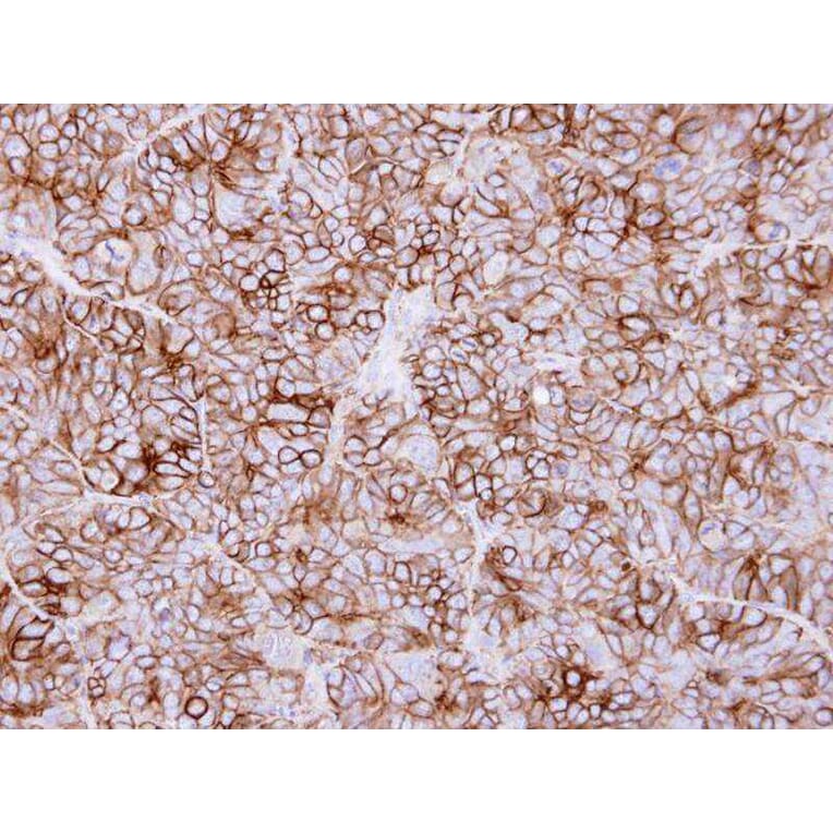 Immunohistochemistry - KIDINS220 antibody from Signalway Antibody (22736) - Antibodies.com