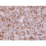 Immunohistochemistry - KIDINS220 antibody from Signalway Antibody (22736) - Antibodies.com