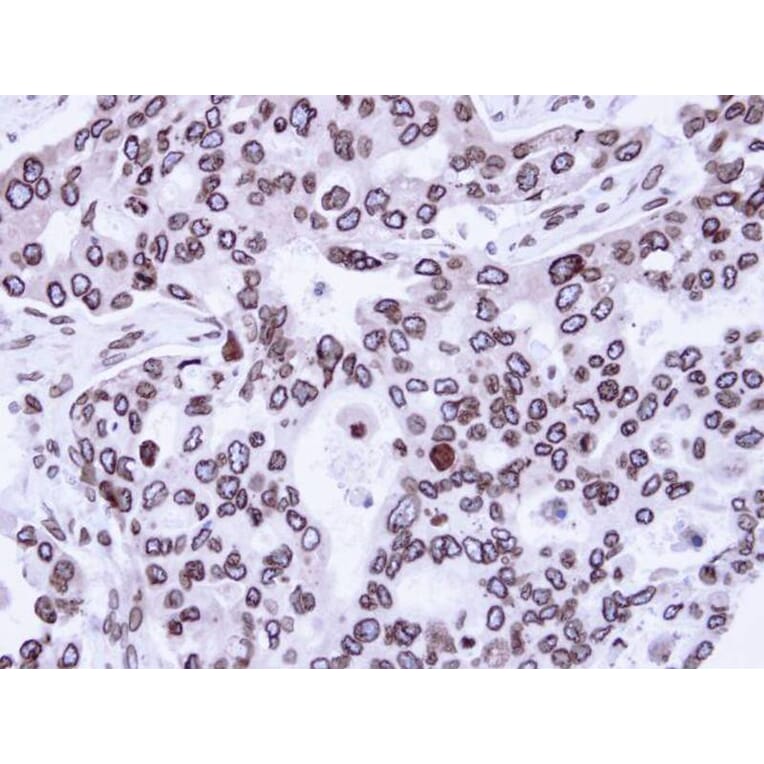 Immunohistochemistry - Lamin A/C antibody from Signalway Antibody (23037) - Antibodies.com