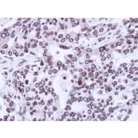 Immunohistochemistry - Lamin A/C antibody from Signalway Antibody (23037) - Antibodies.com
