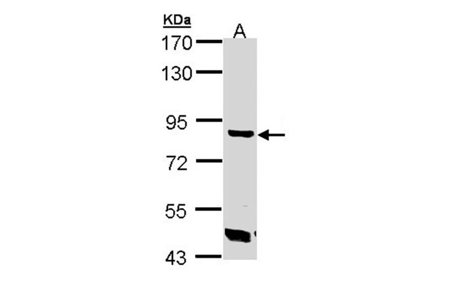 Trehalase antibody from Signalway Antibody (23114) - Antibodies.com