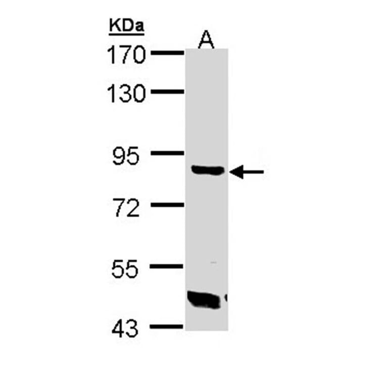 Trehalase antibody from Signalway Antibody (23114) - Antibodies.com