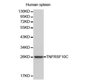 Western blot - TNFRSF10C Antibody from Signalway Antibody (32175) - Antibodies.com