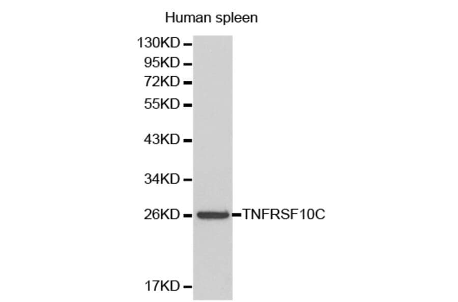 Western blot - TNFRSF10C Antibody from Signalway Antibody (32175) - Antibodies.com