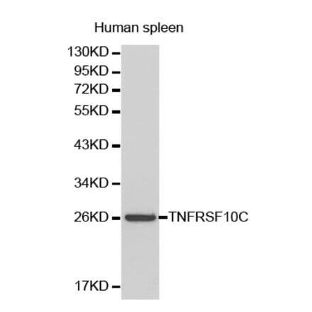 Western blot - TNFRSF10C Antibody from Signalway Antibody (32175) - Antibodies.com