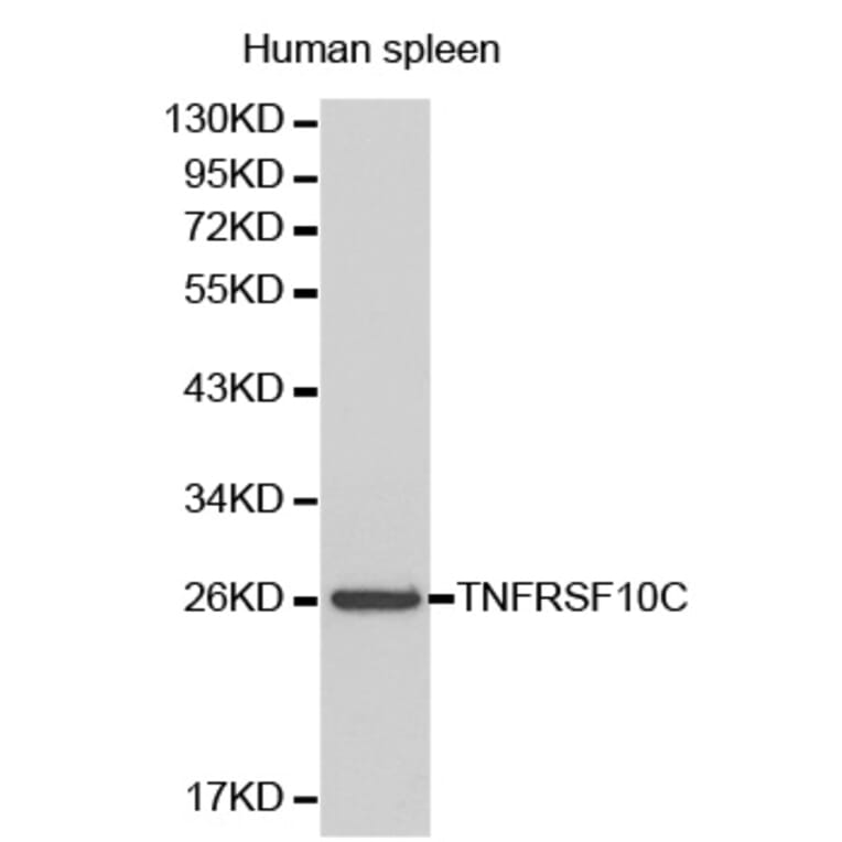 Western blot - TNFRSF10C Antibody from Signalway Antibody (32175) - Antibodies.com