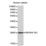 Western blot - TNFRSF10C Antibody from Signalway Antibody (32175) - Antibodies.com