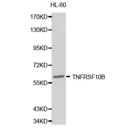 Western blot - TNFRSF10B Antibody from Signalway Antibody (32249) - Antibodies.com