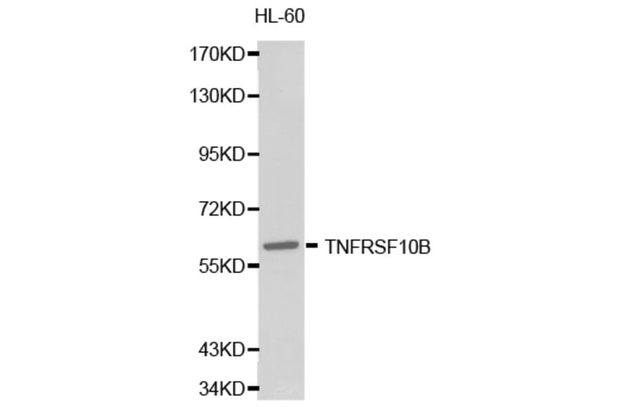 Western blot - TNFRSF10B Antibody from Signalway Antibody (32249) - Antibodies.com