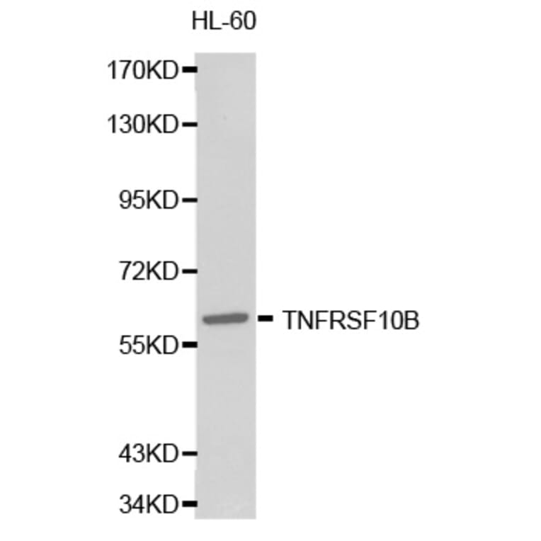 Western blot - TNFRSF10B Antibody from Signalway Antibody (32249) - Antibodies.com