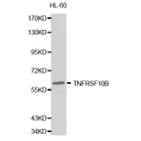 Western blot - TNFRSF10B Antibody from Signalway Antibody (32249) - Antibodies.com