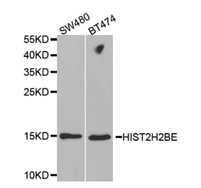 Western blot - HIST2H2BE Antibody from Signalway Antibody (32521) - Antibodies.com