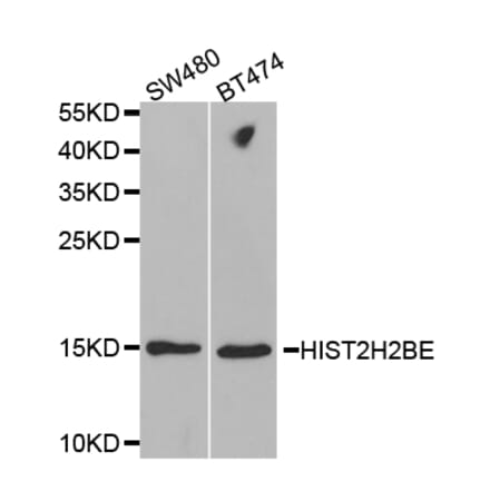 Western blot - HIST2H2BE Antibody from Signalway Antibody (32521) - Antibodies.com