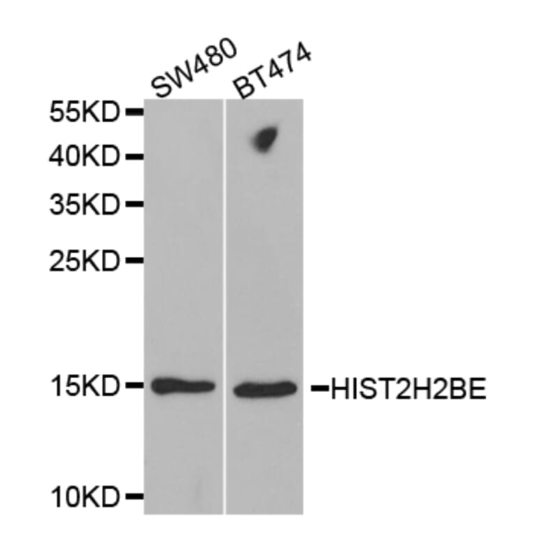 Western blot - HIST2H2BE Antibody from Signalway Antibody (32521) - Antibodies.com