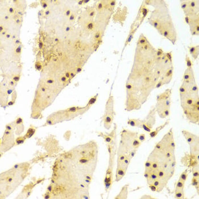 Immunohistochemistry - HIST2H2BE Antibody from Signalway Antibody (32521) - Antibodies.com