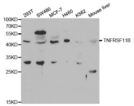 Western blot analysis of extracts of various cell lines, using TNFRSF11B antibody.