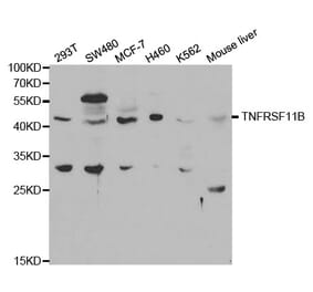 Western blot - TNFRSF11B Antibody from Signalway Antibody (32597) - Antibodies.com