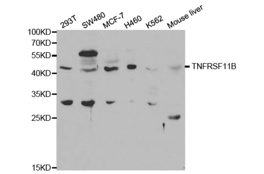 Western blot - TNFRSF11B Antibody from Signalway Antibody (32597) - Antibodies.com
